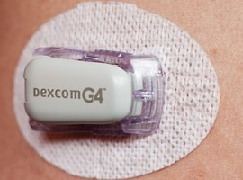 Continuous glucose monitoring (CGM) for diabetes clinical trials